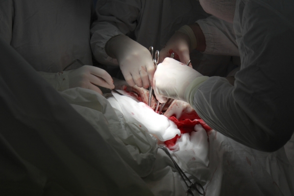 The hands of the surgeons